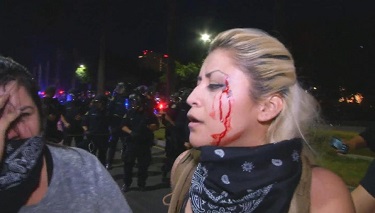 ‘‘Kimsesizlerin Kimi ve Sessiz Yığınların Sesi’’ Donald Trump’a Karşı Protestolar Şiddete Dönüşüyor