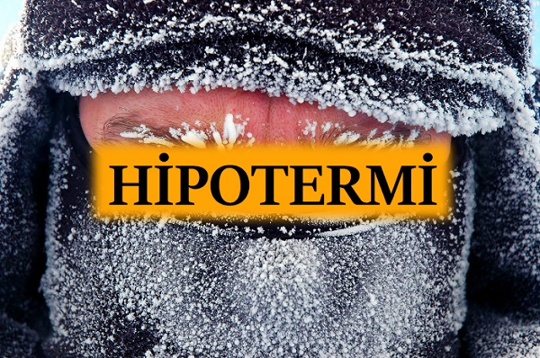Hipotermiden Sakınma