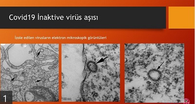 Prof. Dr. Ercüment Ovalı’dan KAMUOYU Açıklaması
